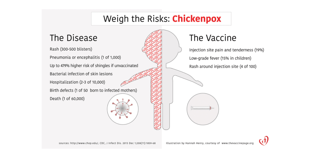 Chickenpox Infographic