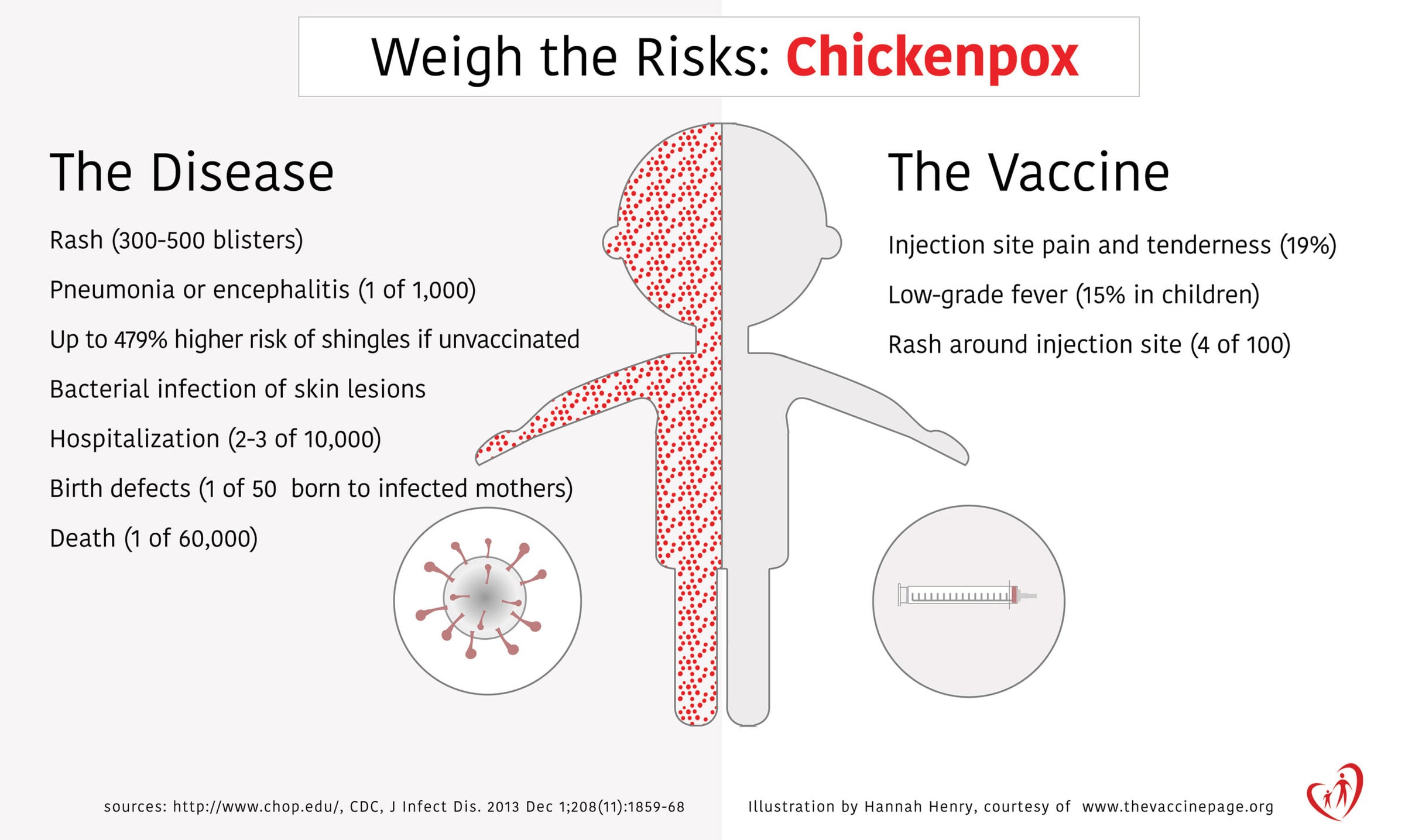 Chicken Pox Infographic