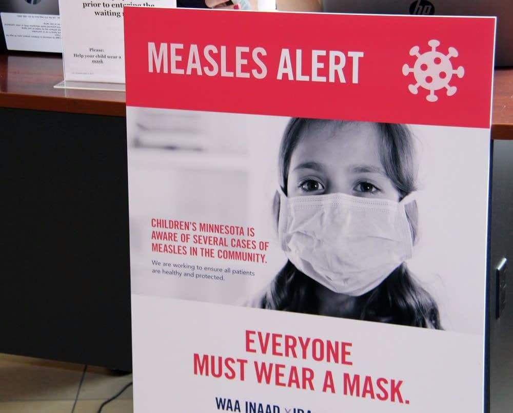 measles alert