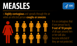 measles