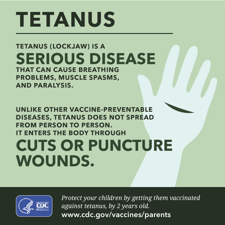 tetanus