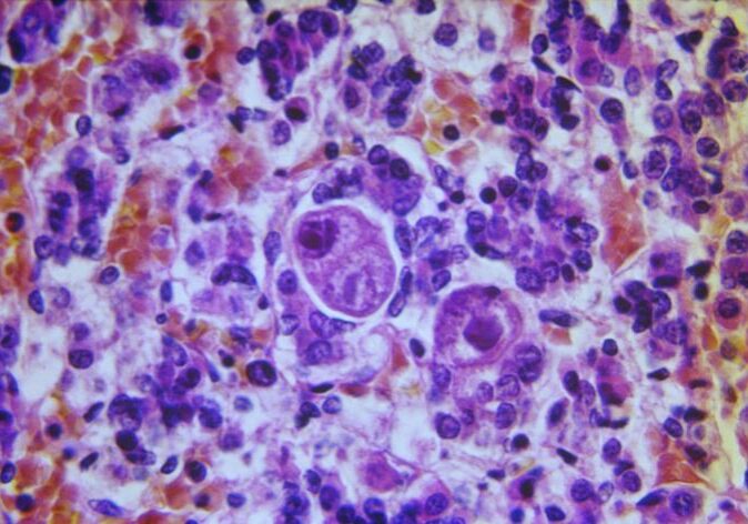 Microscopic image of cytomegalovirus (CMV)?
