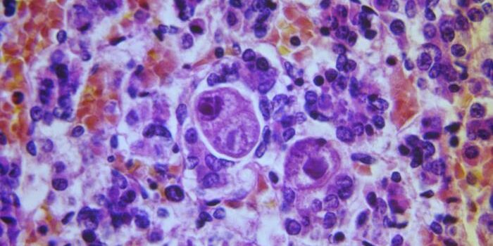 CMV Microscopic image of cytomegalovirus (CMV)?