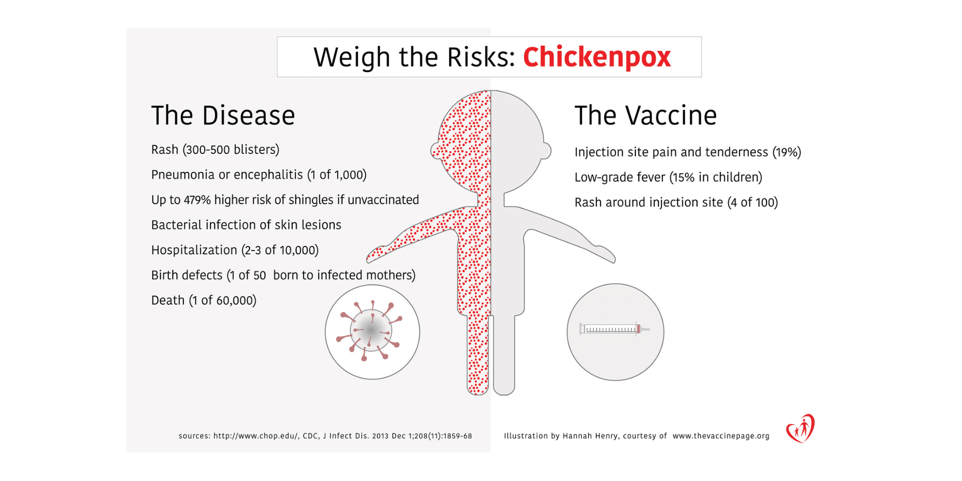 Imagen de varicela-infographic_Featured Gráficos informativos sobre la varicela