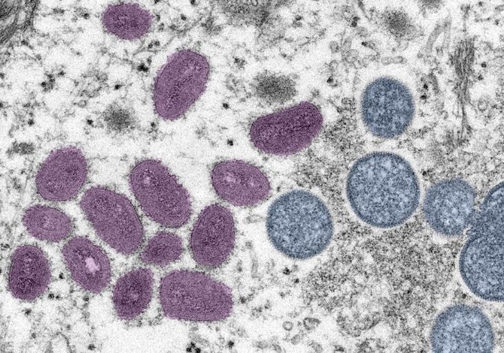 Mpox-Virus-CDC Mpox virus