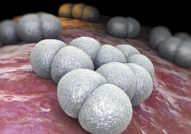 Neisseria meningitidis