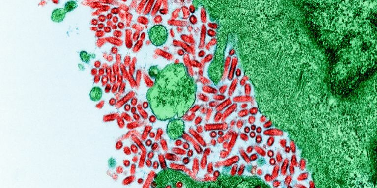 Rabies-Microbiology-NIH Rabies-Microbiology-NIH