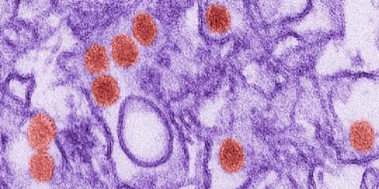 Zika-757x512-1 Zika-757x512-1