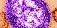 measles-200x201 Measles